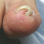 杉浦喜美子様術後