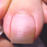 爪が痛い踏ん張れないときはサルース(SALUS)池下店へ