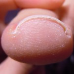 巻き爪ケアのカウンセリングはサルース(SALUS)池下店へ